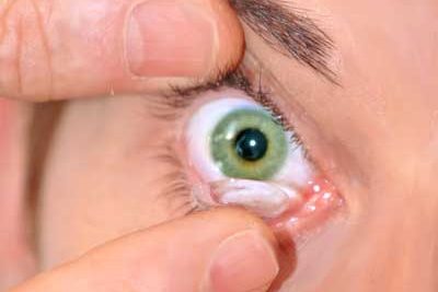 Lentes de Contacto